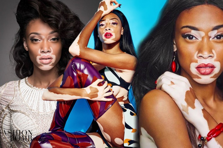 Beauty Crush Wednesdays #BCW: Winnie Harlow