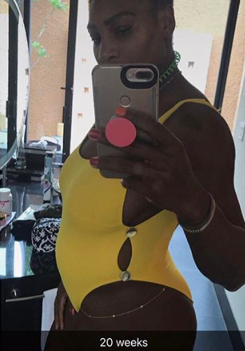 Serena Williams Announces her Pregnancy Wearing a Custom La Blanca Button Side Yellow One Piece Swimsuit