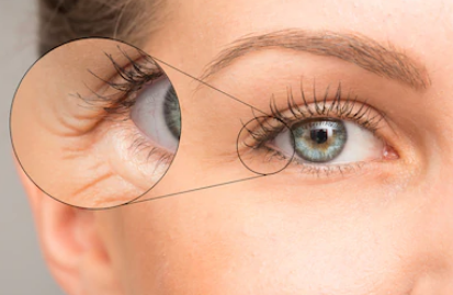 Beauty Tips To Hide Dark Circles and Wrinkles